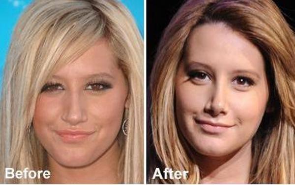 Nose Job