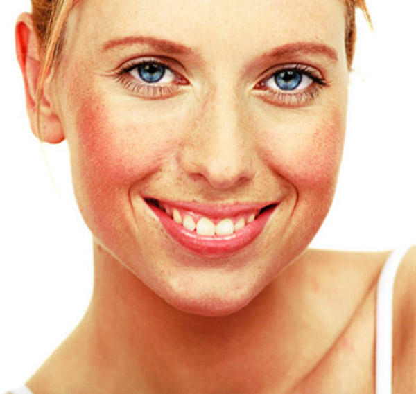 Facial redness
