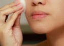 Effectual ways to get rid of stubborn acne