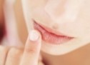 How to treat and prevent chapped lips
